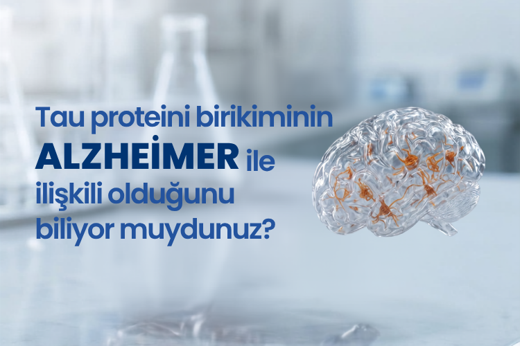 Tau Proteini Birikiminin Alzheimer İle İlişkisi